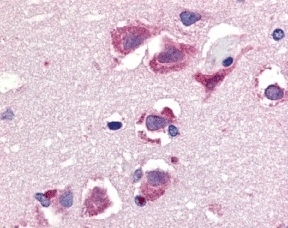 Anti Human CD253 (C-Terminal) Antibody gallery image 1
