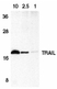 Anti Human CD253 (C-Terminal) Antibody thumbnail image 2