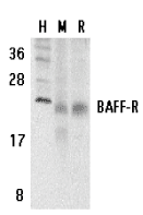 Anti Human CD268 / BAFF-R Antibody gallery image 1