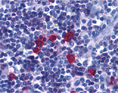 Anti Human CD268 / BAFF-R Antibody gallery image 2