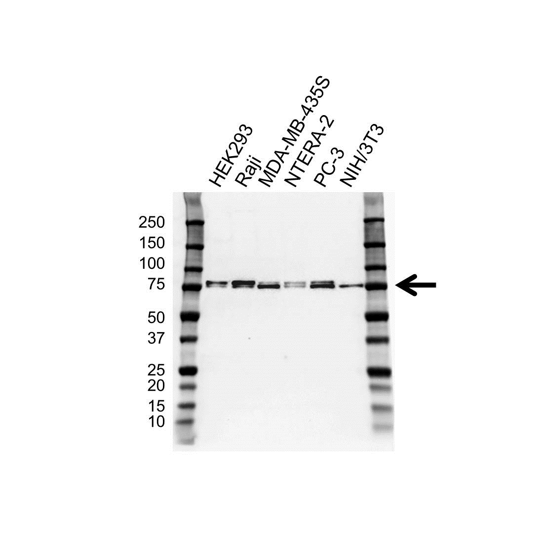 Anti CD271 Antibody (PrecisionAb Polyclonal Antibody) gallery image 1