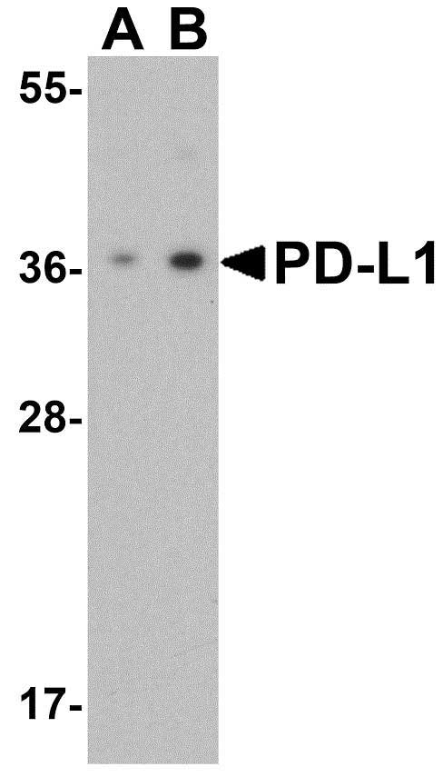 Anti Human CD274 Antibody gallery image 1