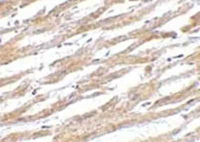 Anti Human CD274 Antibody gallery image 2