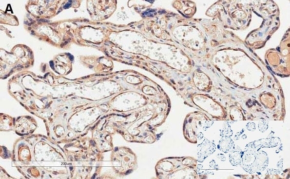 Anti Human CD274 (C-Terminal) Antibody gallery image 2