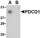 Anti Human CD279 (C-Terminal) Antibody gallery image 1