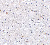 Anti Human CD279 (C-Terminal) Antibody gallery image 2