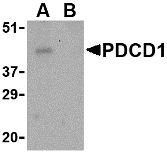 Anti Human CD279 Antibody thumbnail image 1