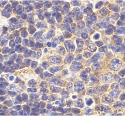 Anti Human CD281 (N-Terminal) Antibody gallery image 2
