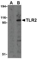 Anti Human CD282 (N-Terminal) Antibody gallery image 1