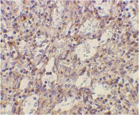 Anti Human CD282 (N-Terminal) Antibody gallery image 2