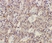 Anti Human CD282 (N-Terminal) Antibody thumbnail image 2
