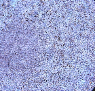 Anti Human CD289 (N-Terminal) Antibody gallery image 1