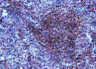 Anti Human CD289 (N-Terminal) Antibody gallery image 2