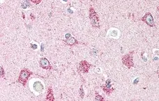 Anti Human CD294 (N-Terminal) Antibody gallery image 1