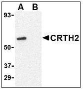 Anti Human CD294 (N-Terminal) Antibody gallery image 4