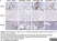 Anti CD331 Antibody (PrecisionAb Polyclonal Antibody) thumbnail image 2