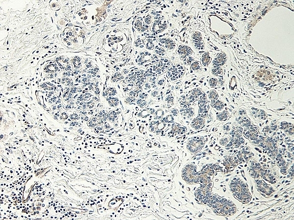 Anti CD54 Antibody (PrecisionAb Polyclonal Antibody) gallery image 3