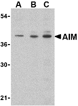 Anti CD5L (C-Terminal) Antibody gallery image 1