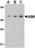 Anti CD5L (C-Terminal) Antibody thumbnail image 1