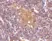 Anti CD5L (C-Terminal) Antibody thumbnail image 2