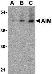 Anti Human CD5L (N-Terminal) Antibody gallery image 1