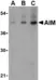 Anti Human CD5L (N-Terminal) Antibody thumbnail image 1