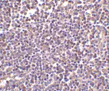 Anti Human CD5L (N-Terminal) Antibody gallery image 2