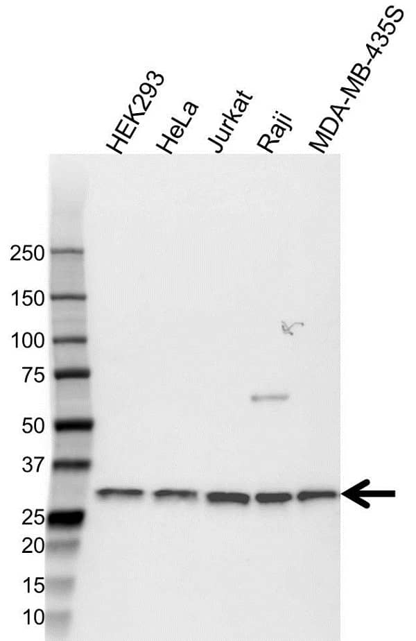 Anti CD8 Beta Antibody (PrecisionAb Polyclonal Antibody) gallery image 1
