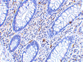 Anti Human CD82 (C-Terminal) Antibody gallery image 2