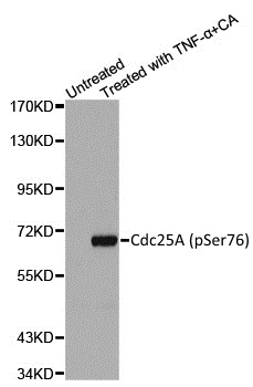 Anti CDC25A (pSer76) Antibody gallery image 1