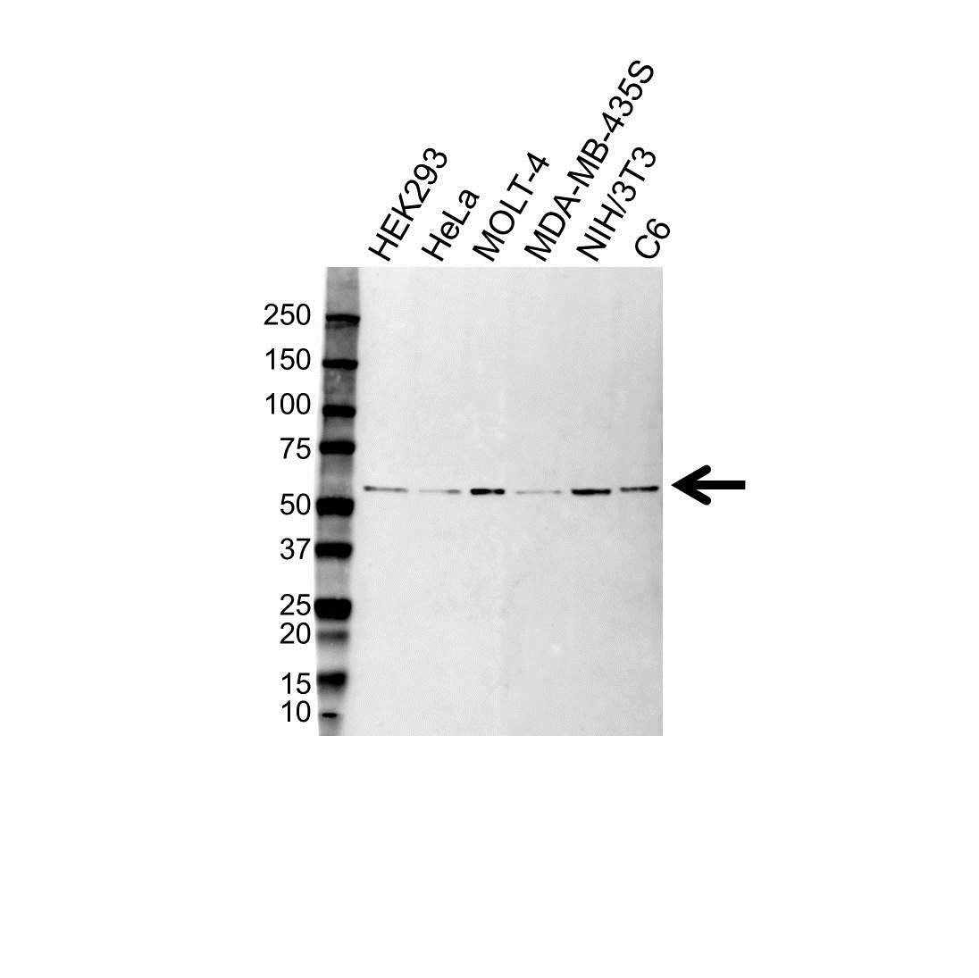 Anti CDC73 Antibody (PrecisionAb Polyclonal Antibody) gallery image 1