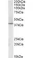 Anti CDK10 Antibody thumbnail image 1