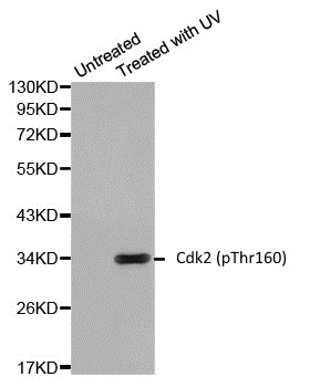 Anti CDK2 (pThr160) Antibody gallery image 1