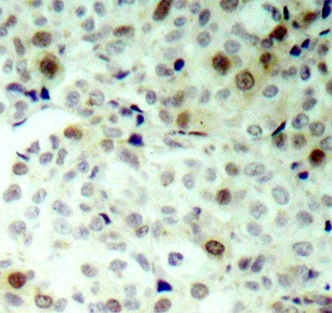 Anti CDK2 (pThr160) Antibody gallery image 2