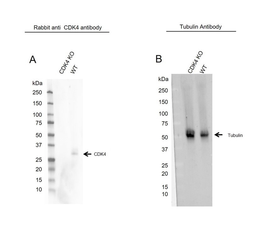 Anti CDK4 Antibody (PrecisionAb Polyclonal Antibody) gallery image 2