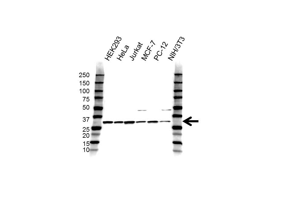 Anti CDK5 Antibody (PrecisionAb Polyclonal Antibody) gallery image 1