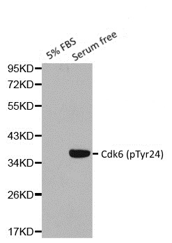 Anti CDK6 (pTyr24) Antibody thumbnail image 1