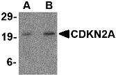 Anti CDKN2A Antibody gallery image 1