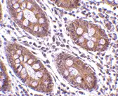 Anti CDKN2A Antibody gallery image 2