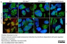 Anti CDKN2A Antibody gallery image 3