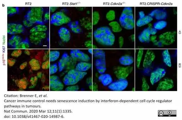 Anti CDKN2A Antibody gallery image 3