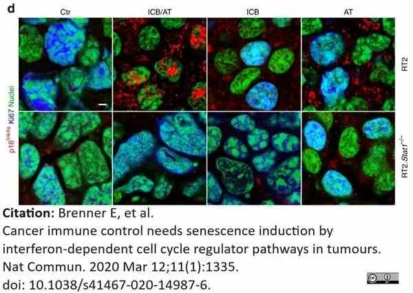 Anti CDKN2A Antibody gallery image 5