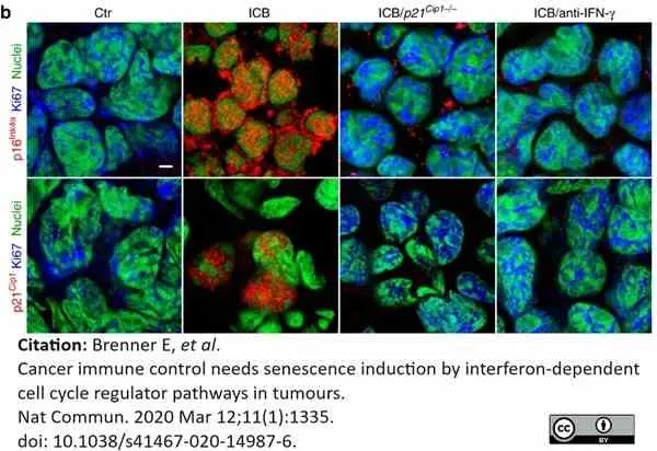 Anti CDKN2A Antibody gallery image 7