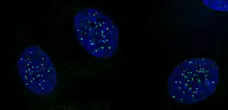 Anti Human CENP-A (pSer18) Antibody gallery image 1