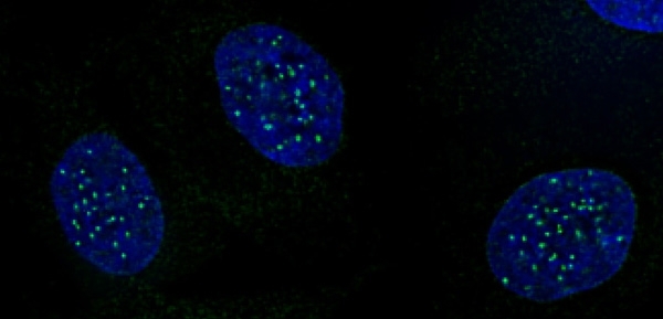 Anti Human CENP-A (pSer18) Antibody gallery image 1