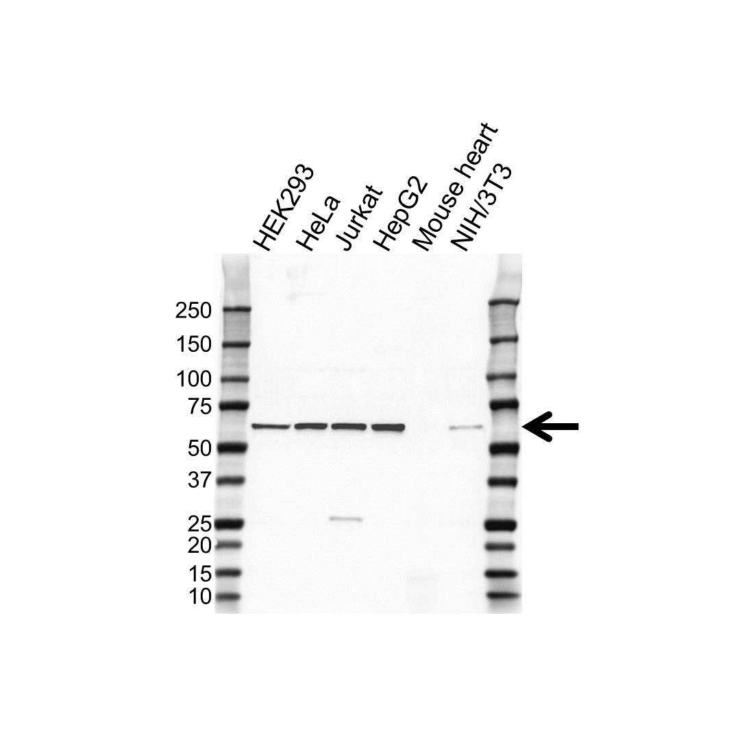 Anti Cerk Antibody (PrecisionAb Polyclonal Antibody) gallery image 1