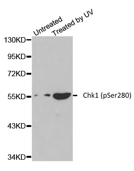Anti Chk1 (pSer280) Antibody gallery image 1