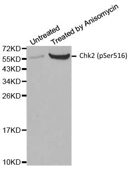 Anti Chk2 (pSer516) Antibody gallery image 1