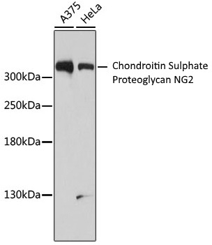 Anti Chondroitin Sulphate Proteoglycan NG2 Antibody gallery image 1