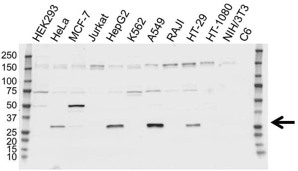 Anti Clathrin Light Chain A/B Antibody (PrecisionAb Polyclonal Antibody) gallery image 1